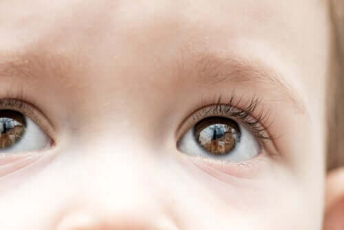Infantilt glaukom