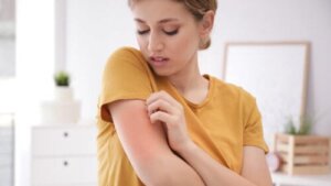 Multippel kjemisk hypersensitivitet, en helseutfordring