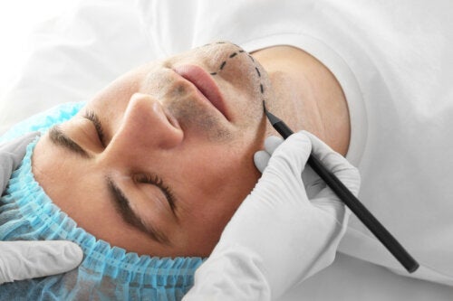 Ansiktsfeminiseringskirurgi: hva er det og hva er risikoen?