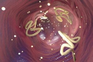 Eliminer tarmparasitter med hvitløk og gresskarfrø