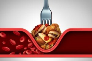 Kolesterol: 9 strategier for å hjelpe deg med å senke nivåene dine