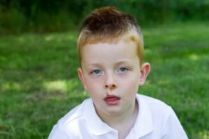 Impetigo: Symptomer og årsaker