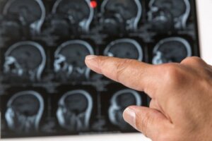 Kan klumper på hodet være svulster?