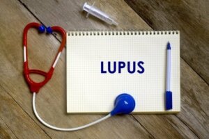 Hva er risikofaktorene for lupus?