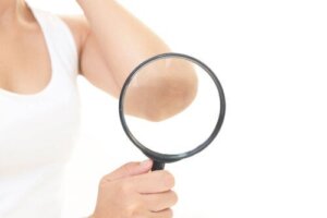 Hvordan bli kvitt mørke albuer og knær naturlig