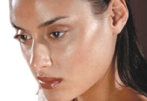 Hvordan behandle fet hud