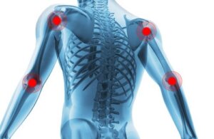 Hvordan behandle leddslitasje