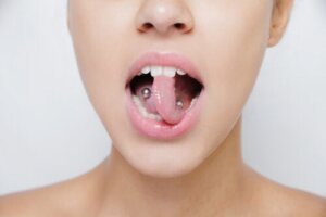 Piercing i munnen kan ha konsekvenser for munnhelsen