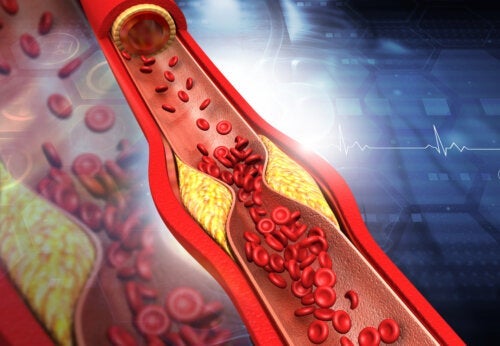 Symptomer og tips for å øke HDL-kolesterolnivået