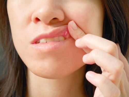 Hva er et oralt fibrom og hvordan påvirker det oral helse?