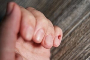 Hvordan gjenkjenne neglesvulster