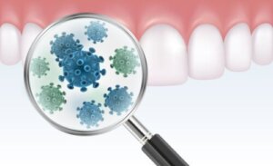 Alt du trenger å vite om bakteriell tannplakk
