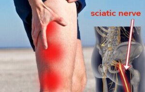 Medisiner for isjiasnervesmerter