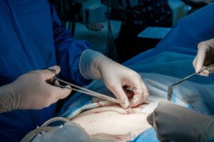 Hudtransplantasjon: Når brukes det?