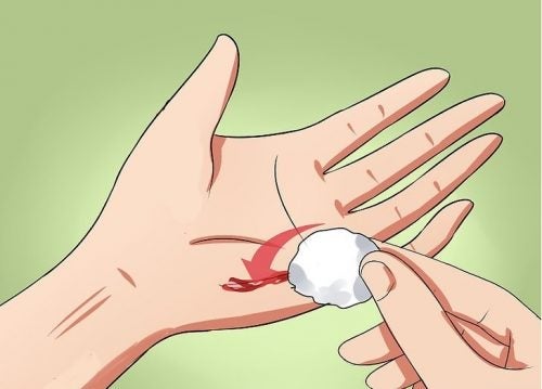 Hvordan forhindre at et sår blir infisert
