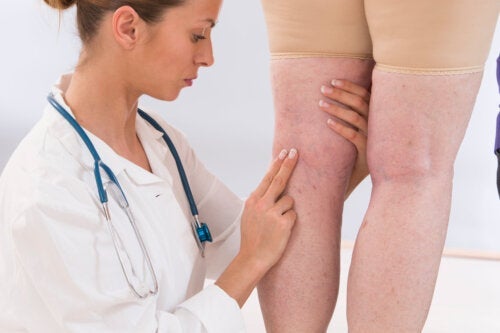 11 Symptomer på dårlig sirkulasjon i bena og føttene