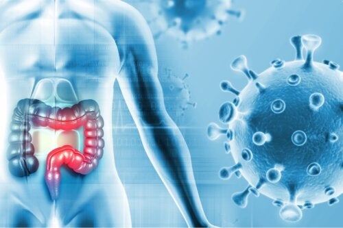 En ny studie identifiserer munnbakterier som kan forårsake tykktarmskreft