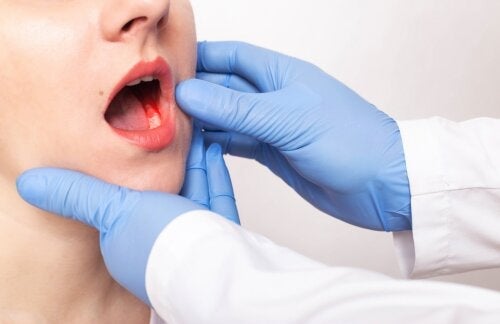 Symptomer og årsaker til periodontitt