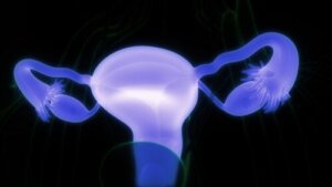 Dermoidcyster på eggstokkene: symptomer og når du bør oppsøke lege