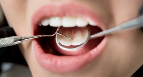 7 Konsekvenser av dårlig tannhygiene for helsen din