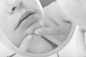 Hvordan bli kvitt blinde kviser