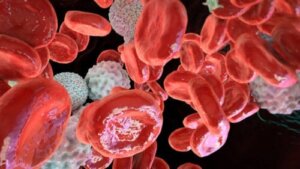 Polycytemi Vera: årsaker, symptomer, diagnose og behandling