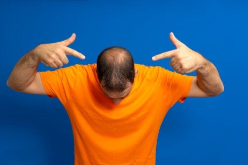 Hårpleie for menn: En guide for å forhindre skallethet