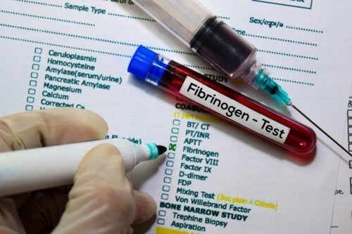 Blodprøve for å sjekke fibrinogen: funksjoner og resultater