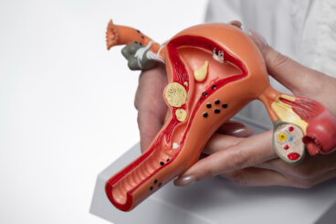 Endometriose: symptomer du ikke bør ignorere og moderne behandlinger